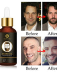 Natural Beard Growth Oil